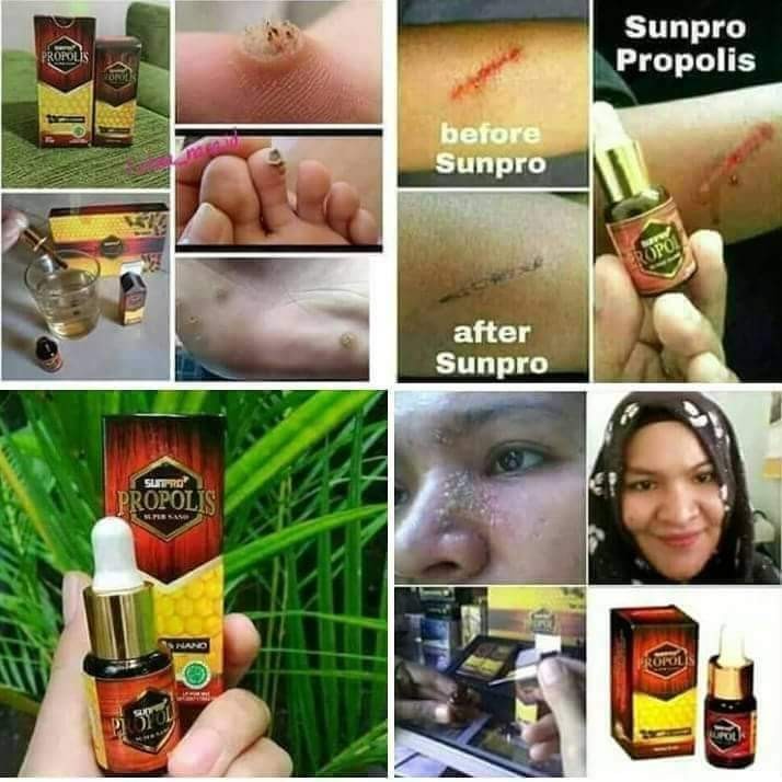 Cek Manfaat Propolis Nasa Untuk Ibu Hamil 