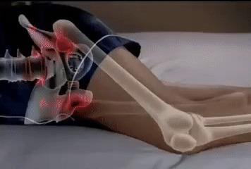 Orthopedic leg pillow Carousell