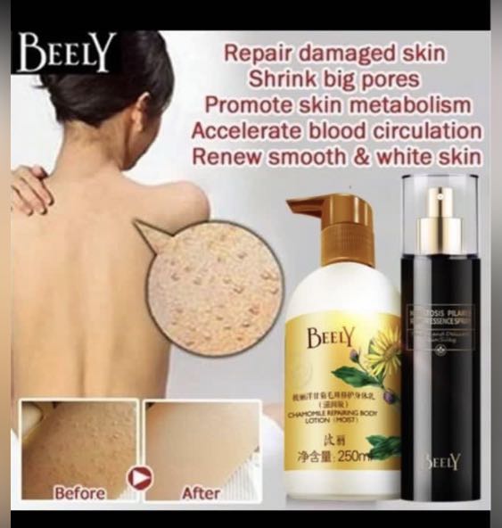 Keratosis Pilaris, Beauty & Personal Care, Bath & Body, Body Care on