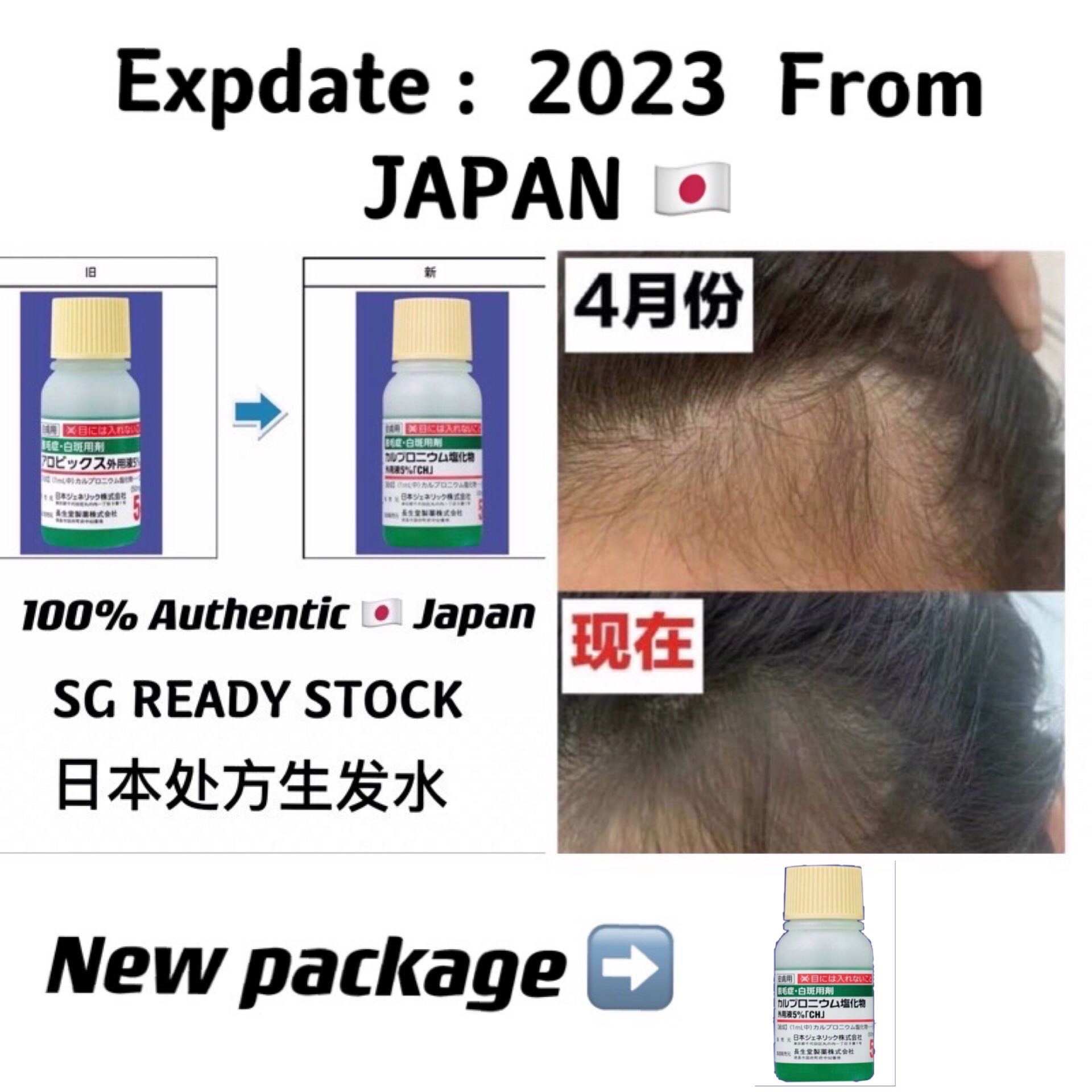 Japan Authentic No 1 Hair Growth Tonic 30ml X 1 日本处方药生发水防脱发脱毛症治疗剂 日本处方药 脱毛症育毛剂30ml Hair Tonic Health Nutrition Health Supplements Health Food Drinks