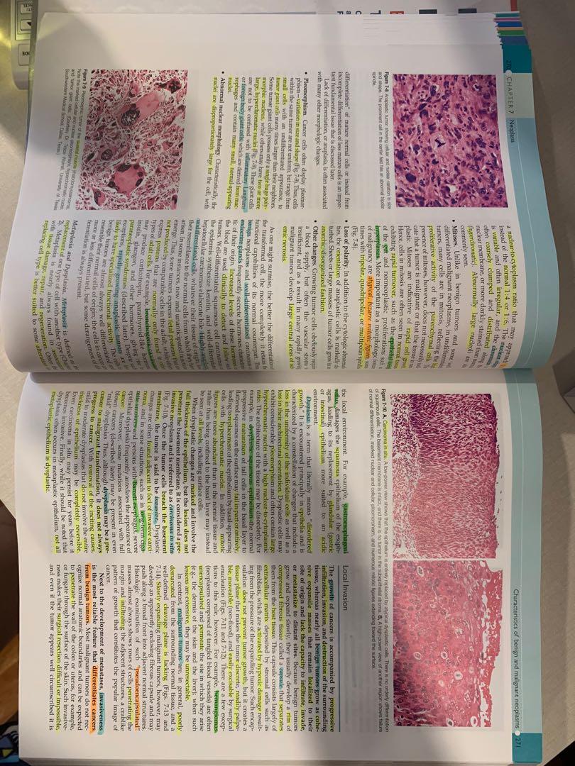 Robbins and Cotran Pathologic Basis of Disease 9th edition (Category: Textbooks) located in Manila. Submitted by moniquecloset (Listing ID 1113747140, Image 2). Description: Only Neoplasia Chapter has highlights Good as new! With plastic cover .