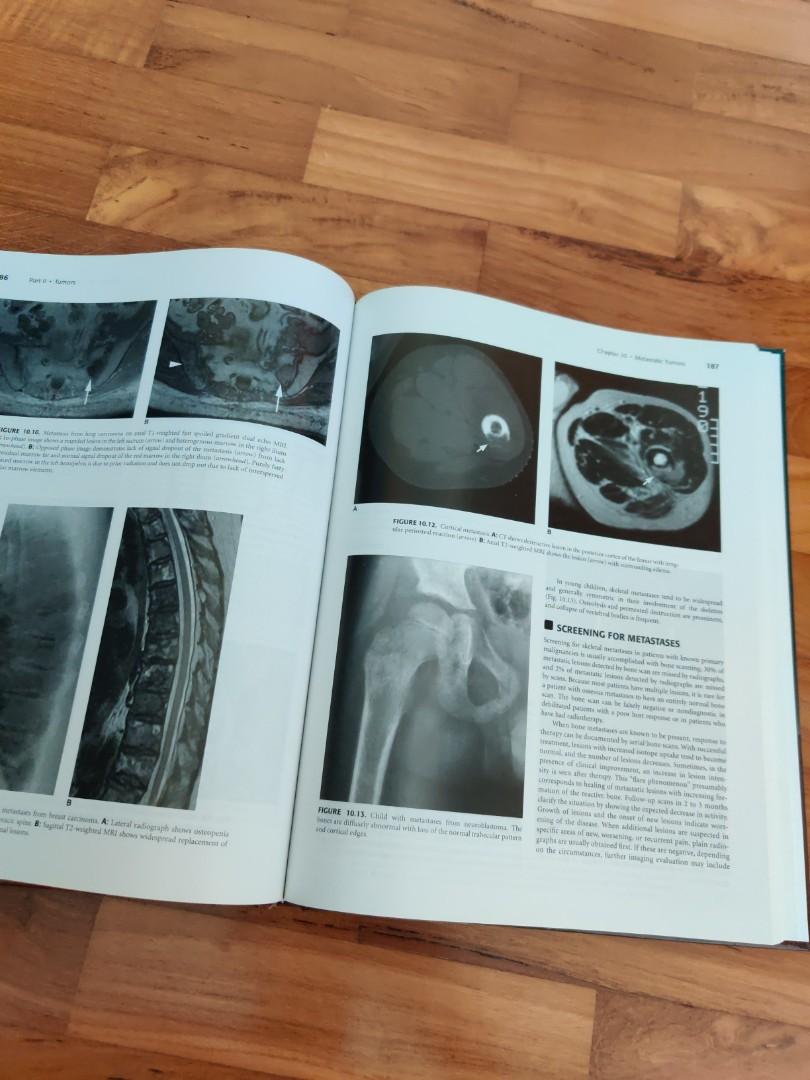 Skeletal radiology, Hobbies & Toys, Books & Magazines, Textbooks on