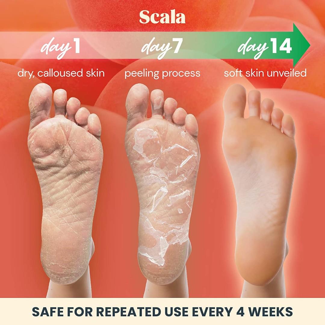 Dry feet peeling store treatment