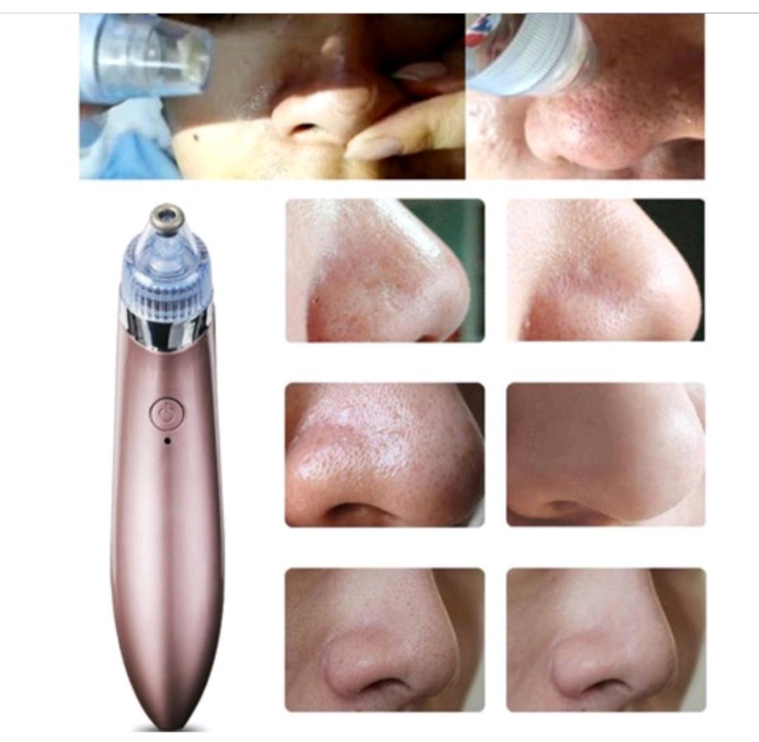 Rechargeable 5 Speed Blackhead removal and WhiteHead Vacuum Pore