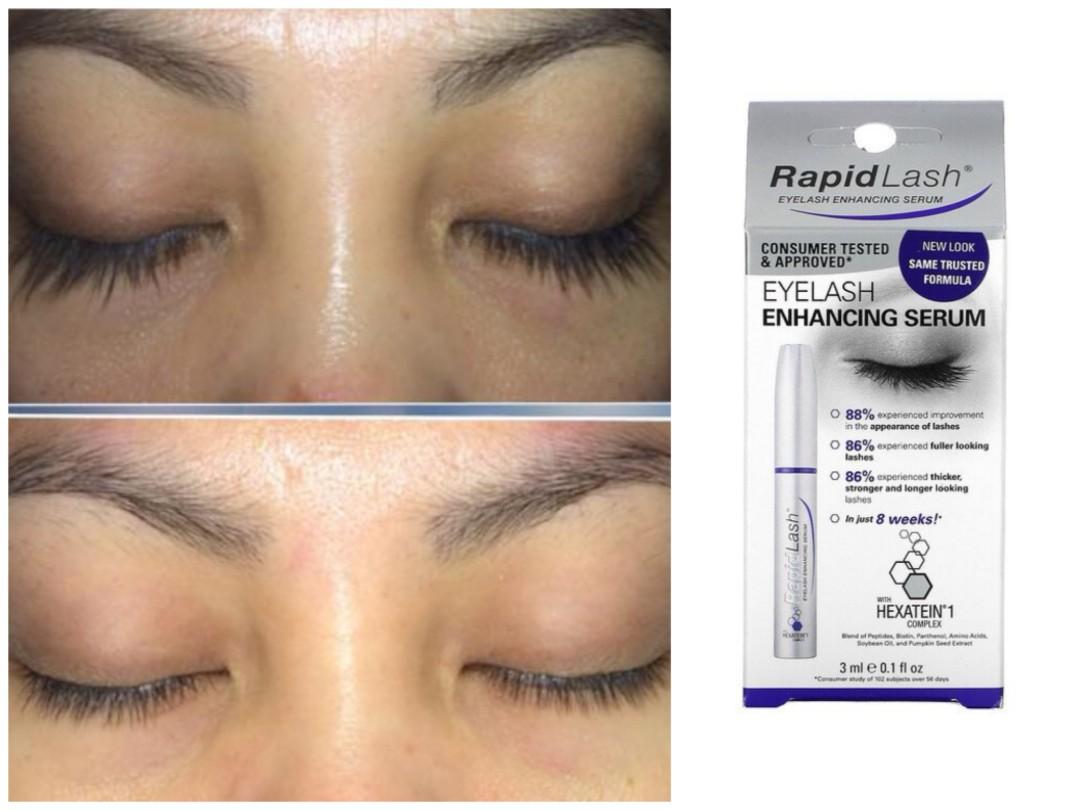 RapidLash Eyelash Enhancing Serum, 0.1 fl oz (3 ml) (Category: Hair) located in Quezon City. Submitted by u.need.ph (Listing ID 1135453151, Image 1). Description: [PRE-ORDER] ETA: 7-10 Days - 100% Authentic - From USA - Imported - 100% Real Photo Product Reviews - Consumer Tested & Approved* - 88% Experience Improvement in the Appearance of Lashes - 86% Experienced Fuller Looking Lashes - 86% Experienced Thicker, Stronger and Longer Looking Lashe