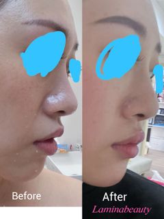 （分類：）位於 。 由 barbie0830 提交（商品編號 1188094373，圖片 1）。簡介： 。