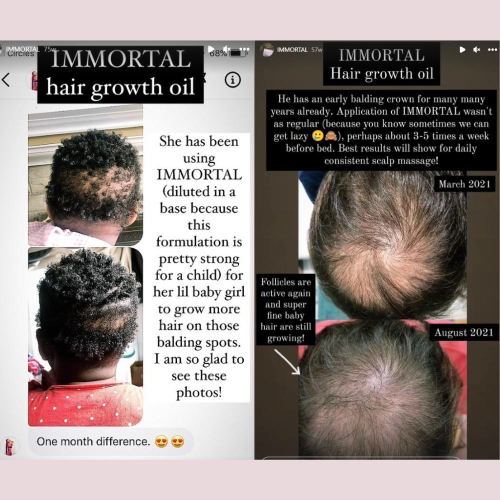 VIZU] IMMORTAL hair growth tonic, anti hair-fall - 30g & 100g (Herbal  Remedies Series), Beauty & Personal Care, Hair on Carousell
