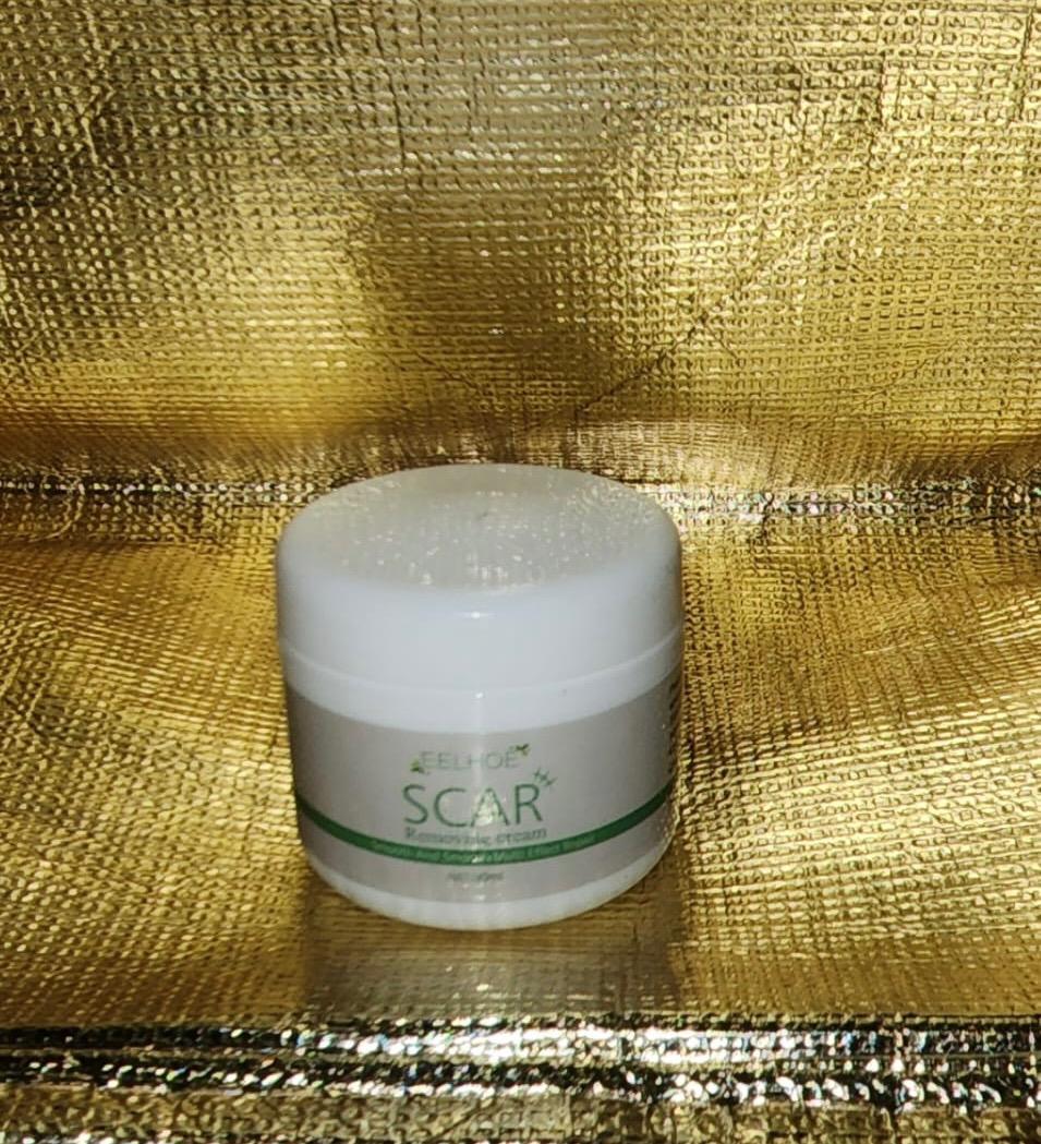 Scar removal cream, Babies & Kids, Maternity Care on Carousell