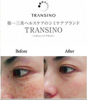 Japanese Transino II tablets with tranexamic acid, L-cysteine, vitamin C for skin whitening melasma pigmentation freakles