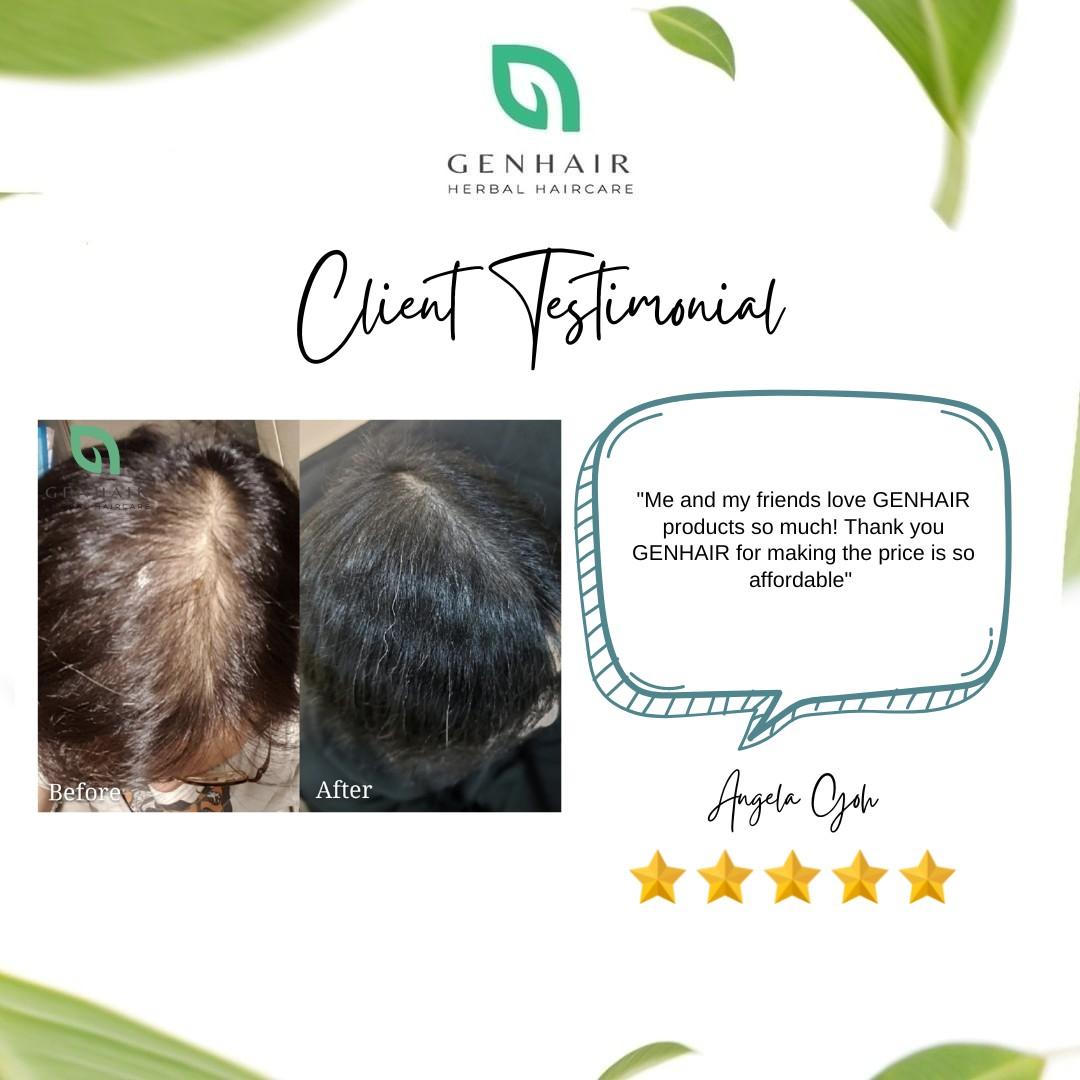 JG Japan best hair fall serum tonic for hair growth hair loss