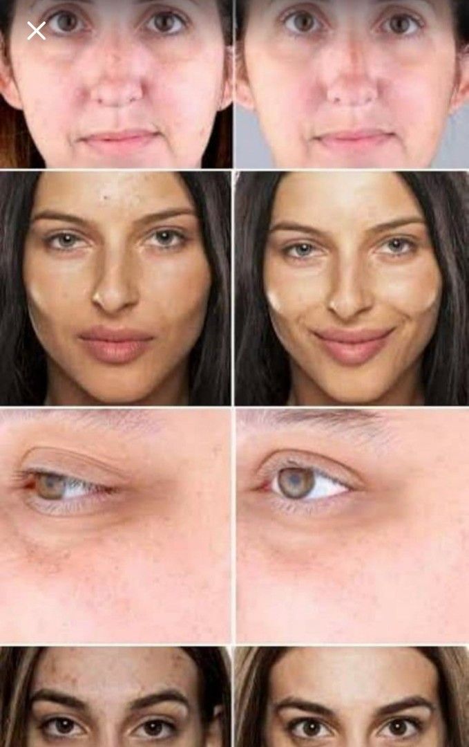 Perfectio Zero gravity (Category: Face Care) located in San Juan City. Submitted by ellaineb04 (Listing ID 1198212999, Image 3). Description: For sale Perfectio Zero gravity for a lowest price., need funds. for only 20k.