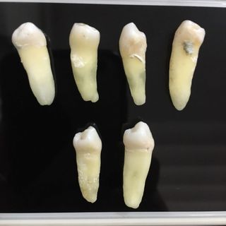 Natural Tooth Mandi Premolars