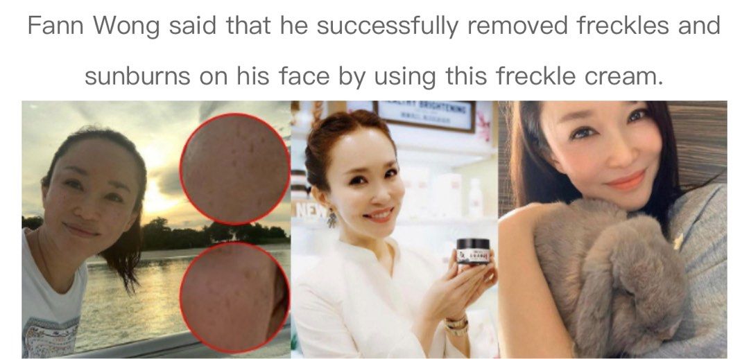 HIISEES Skin Brighten Skin Whitening Freckle Sunburn Cream 30g Gently ...