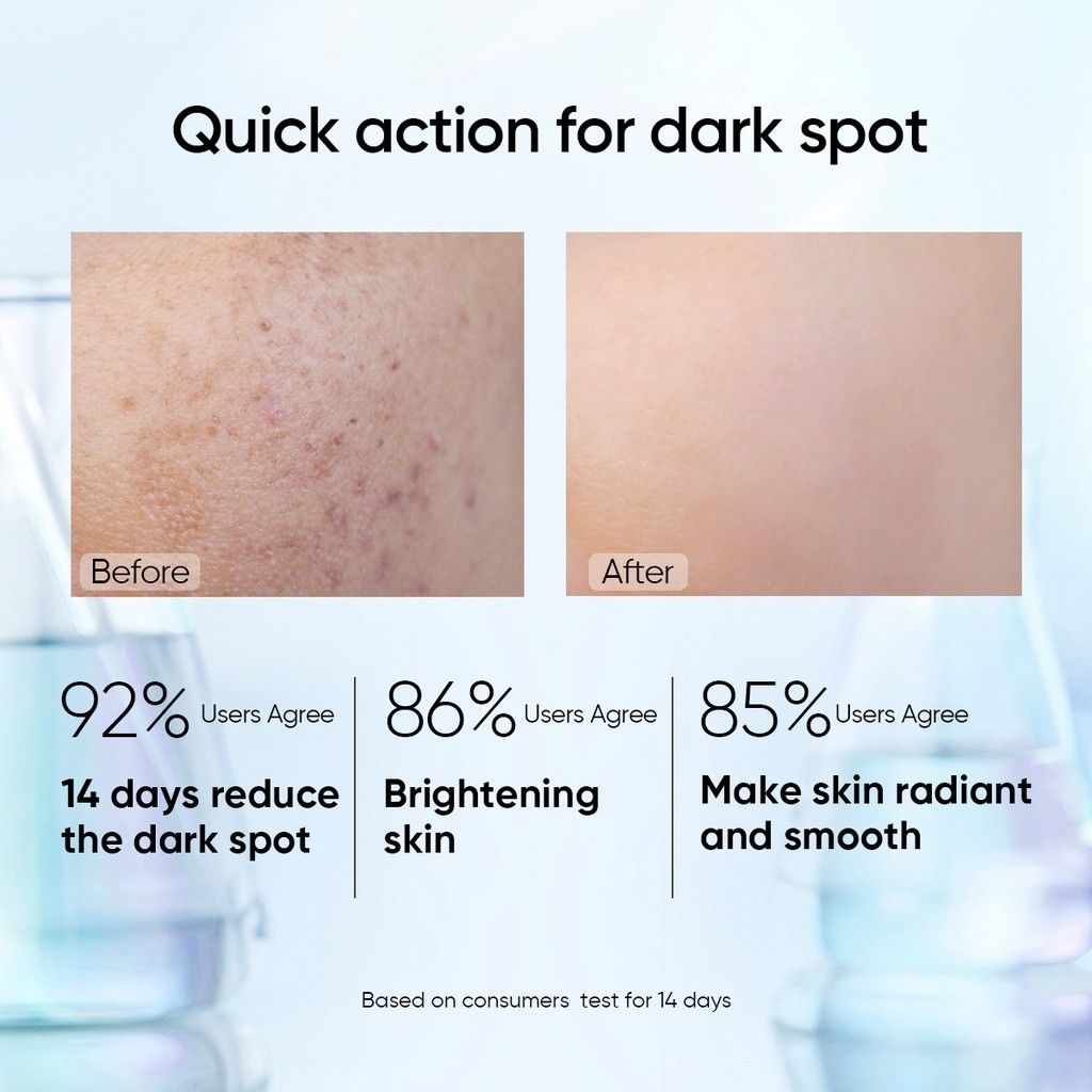 Skintific Anti Dark Spot Serum set, Beauty & Personal Care, Face, Face ...