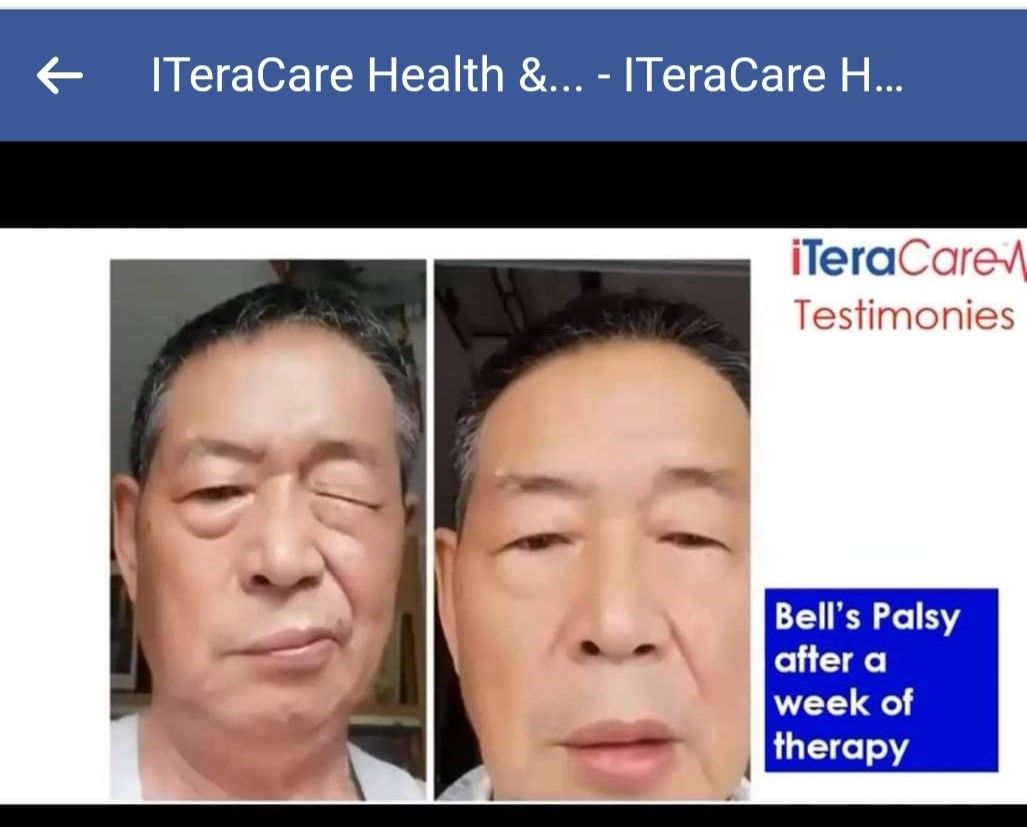 Itera care therapy device, Health & Nutrition, Assistive & Rehabilatory ...