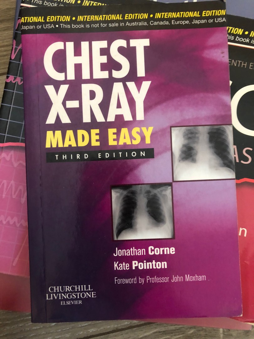 Chest xray made easy, 興趣及遊戲, 書本 & 文具, 教科書 Carousell