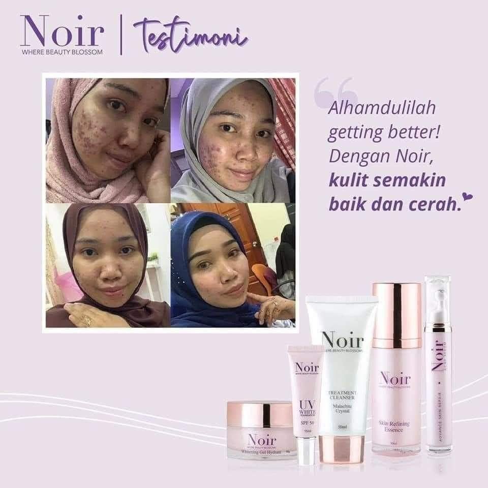 Noir skincare outlet