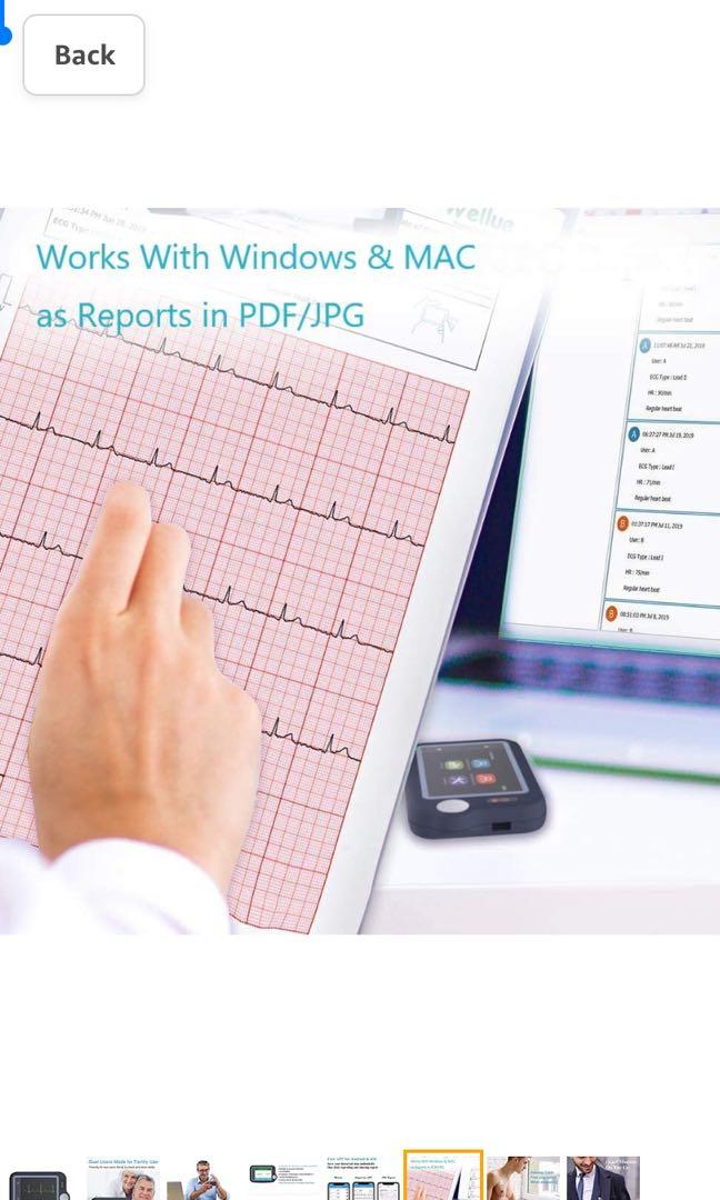 ViATOM EKG Monitor - Tragbares EKG Gerät Mit App | Bluetooth Herzüberwachung