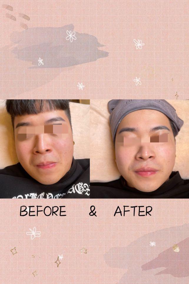 Watershine BB glow facial (Category: Face Care) located in Singapore. Submitted by starfishhhhhh (Listing ID 1145862000, Image 1). Description: Korea WATERSHINE bb glow facial First trial :$48!! 1.Double cleanse 2.exfoliate 3.extraction 4.massage 5.ampoule serum (additional $10) 6.bb ampoule 7.mask & led light therapy ✅immediate brightening & lightening of complexion ✅reduce dark circles & blackheads &clogged pores ✅does not rub off / wash off ✅r