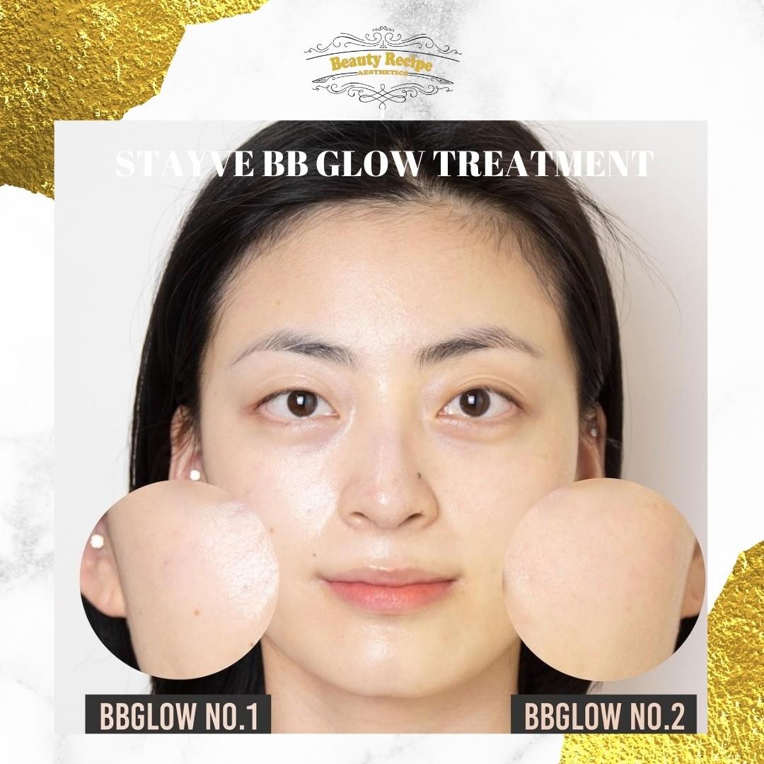 Pay Nothing BB Glow & various facial treatment courses SkillsFuture Grant (Category: Beauty & Health Services) located in Singapore. Submitted by beautyrecipe (Listing ID 1141819123, Image 2). Description: Pay Nothing to learn the Best Korean Skin Treatments with Skills Future Credit? $300 course fees fully claimable. You will be learning about all the latest skin treatments: - BB Glow Color - Proper Double Deep Cleansing - Face Massage Technique