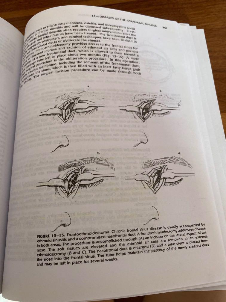 Boies Fundamentals of Otolaryngology 6e Hobbies Toys Books Boies Fundamentals of Otolaryngology 6e Hobbies Toys Books