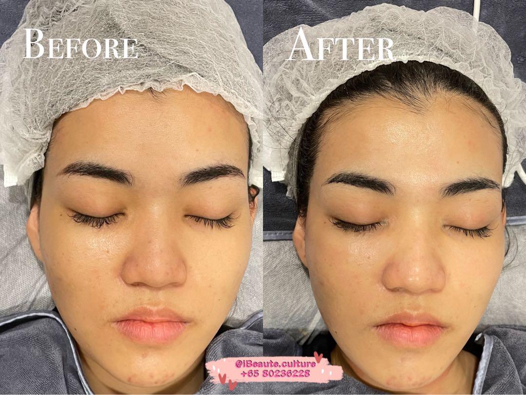 Watershine BB Glow (Category: Face Care) located in Singapore. Submitted by ibeaute.studio (Listing ID 1147658899, Image 2). Description: First trial @ $68nett!! UP: $88 🪄 To celebrate Women's Day, only carousell user whom book our first trial gets a free Express Gel Manicure!! Worth $18!! ⚠️ BY APPOINTMENTS ONLY ‼️ 📍 Far East Plaza. #01-98 💎 DM US: +65 80238898💎 ▶️ CASH/ PAYNOW payments only! 🌻 Monday-Friday: 11am till 8pm 🌻 Sat/Sun/PH: 12