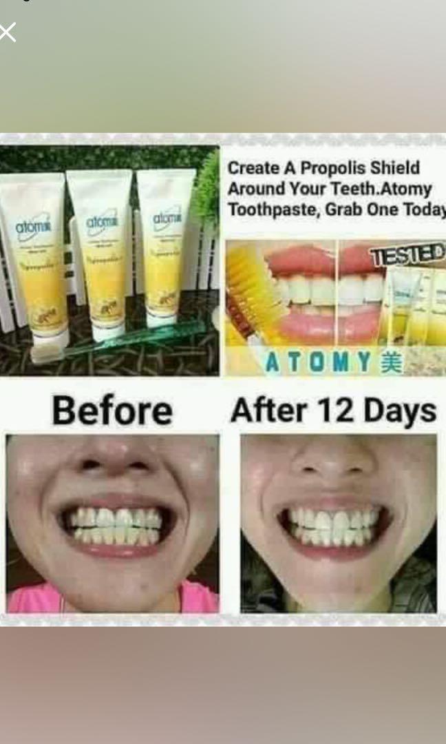 Atomy Toothpaste (200g), Beauty & Personal Care, Oral Care on Carousell