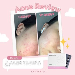(Category: ) located in . Submitted by fayclicious.sg (Listing ID 1158043390, Image 1). Description: .