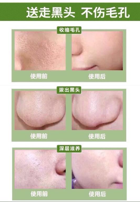 MASK GREEN TEA ACNE CLEARING PEEL OFF MASK CLEANSING POWDER TEARING