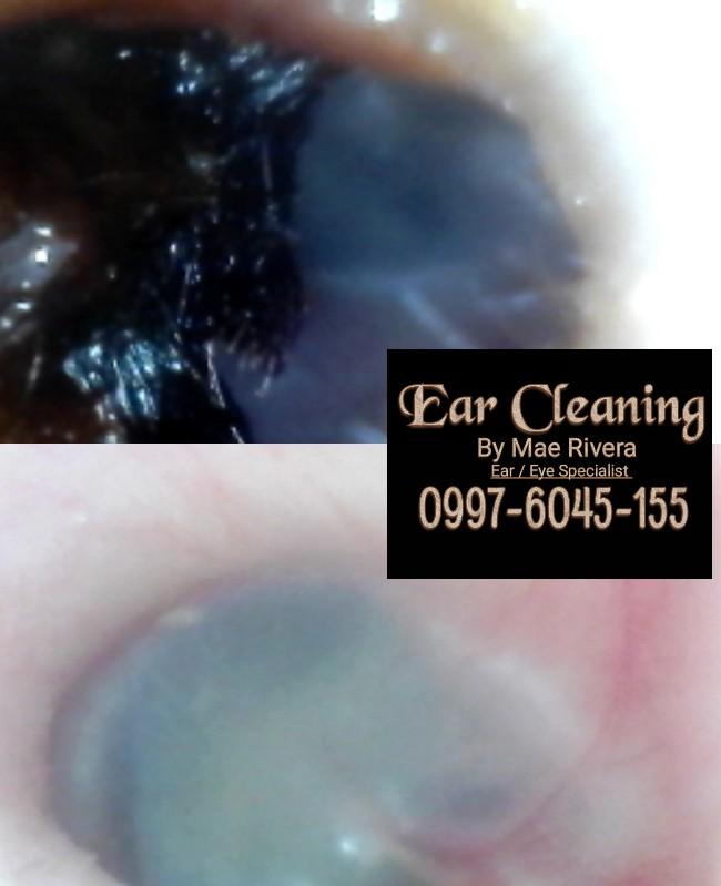 Home service. Ear and. Eye cleaning (Category: Other Audio Equipment) located in Rizal. Submitted by xiqxaijan (Listing ID 1002157597, Image 2). Description: Please like and share my page for more videos and information 😍😍😍😍 Nakakaramdam kaba ng mga sumusunod??? ✅Makati ang tenga ✅May umuugong ✅May umaalog ✅Mabaho ang amoy ✅Nagsisipon ✅Madaming black and white heads ✅May Tagyawat sa loob ✅Nabibingi ✅Pakiramdam nyu laging mag gumagalaw sa loob