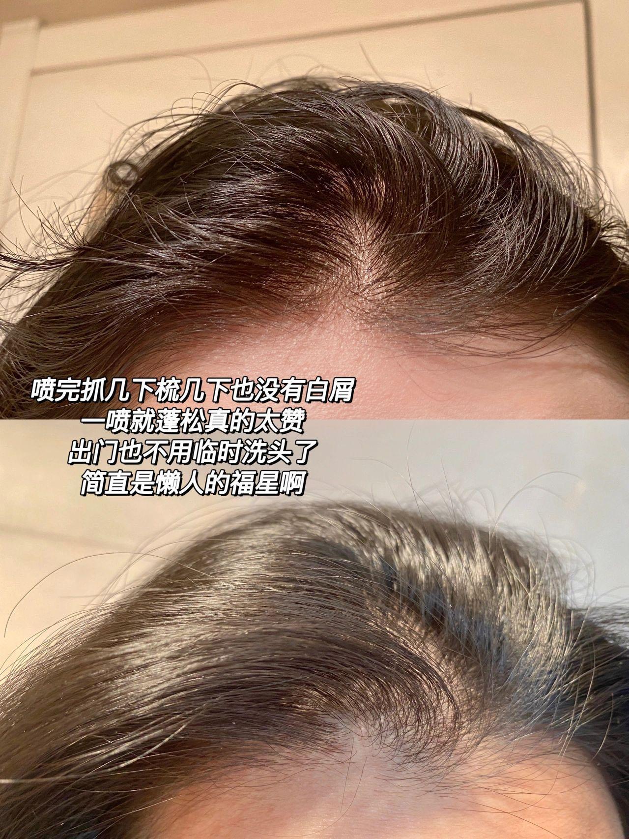 Spes Dry Shampoo, Beauty & Personal Care, Hair on Carousell