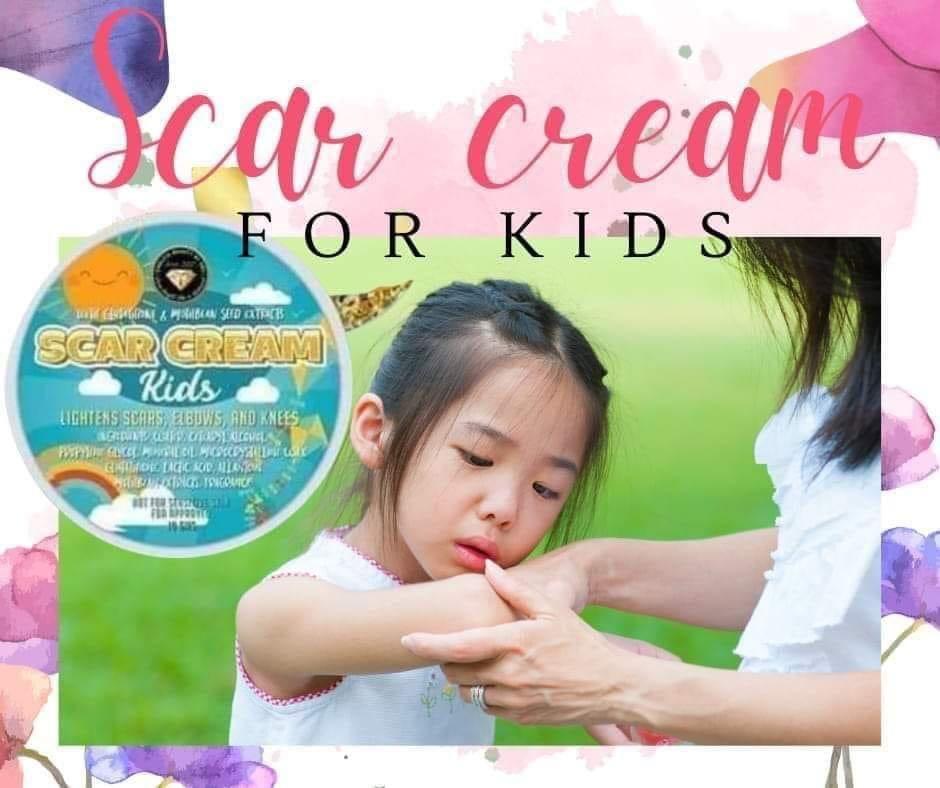 Scar Cream for kids, Babies & Kids, Baby Monitors on Carousell