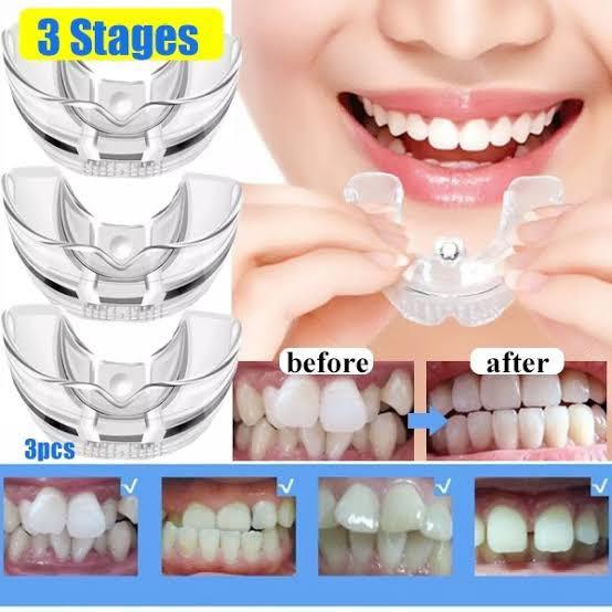 Teeth Aligner Invisible Braces (Category: Braces, Support & Protection) located in Mandaluyong City. Submitted by lady.lannister (Listing ID 1163800053, Image 2). Description: Use at your own risk! brand new and never been opened. Similar to Smicare’s Teeth Aligners .