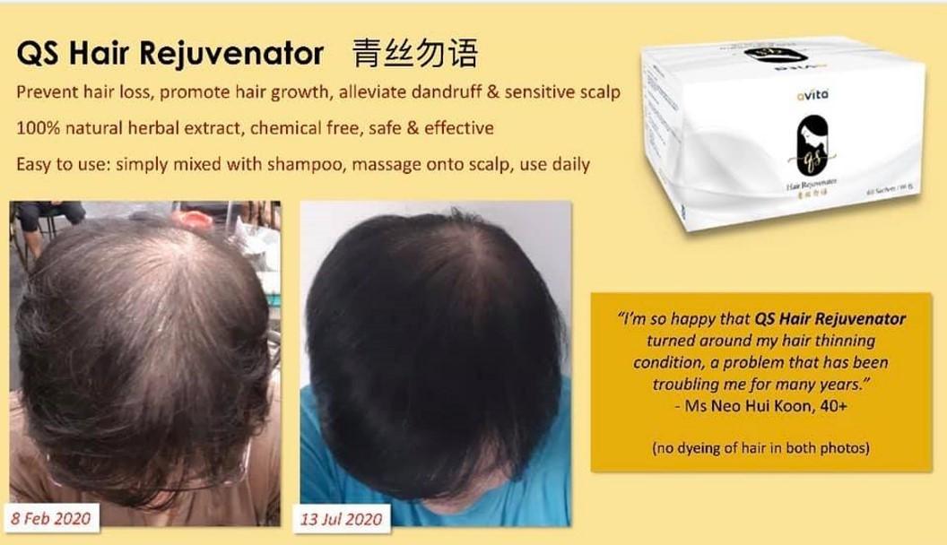 60 Sachets) QS Hair Rejuvenator Balding Hair Loss Sensitive Scalp Dandruff  TCM Herbal Natural Singapore, Beauty & Personal Care, Hair on Carousell