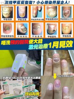（分類：）位於 。 由 rubera_store 提交（商品編號 1167085554，圖片 1）。簡介： 。