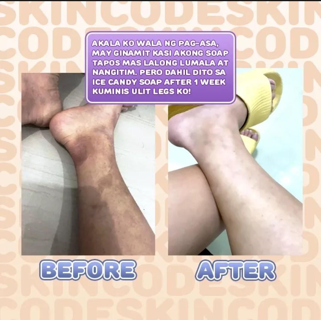 Ice Candy Whitening and Anti Aging Soap, Beauty & Personal Care, Bath & Body, Bath on Carousell