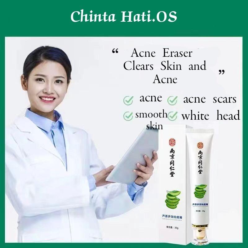 Removing Acne Cream, Beauty & Personal Care, Face, Face Care on Carousell