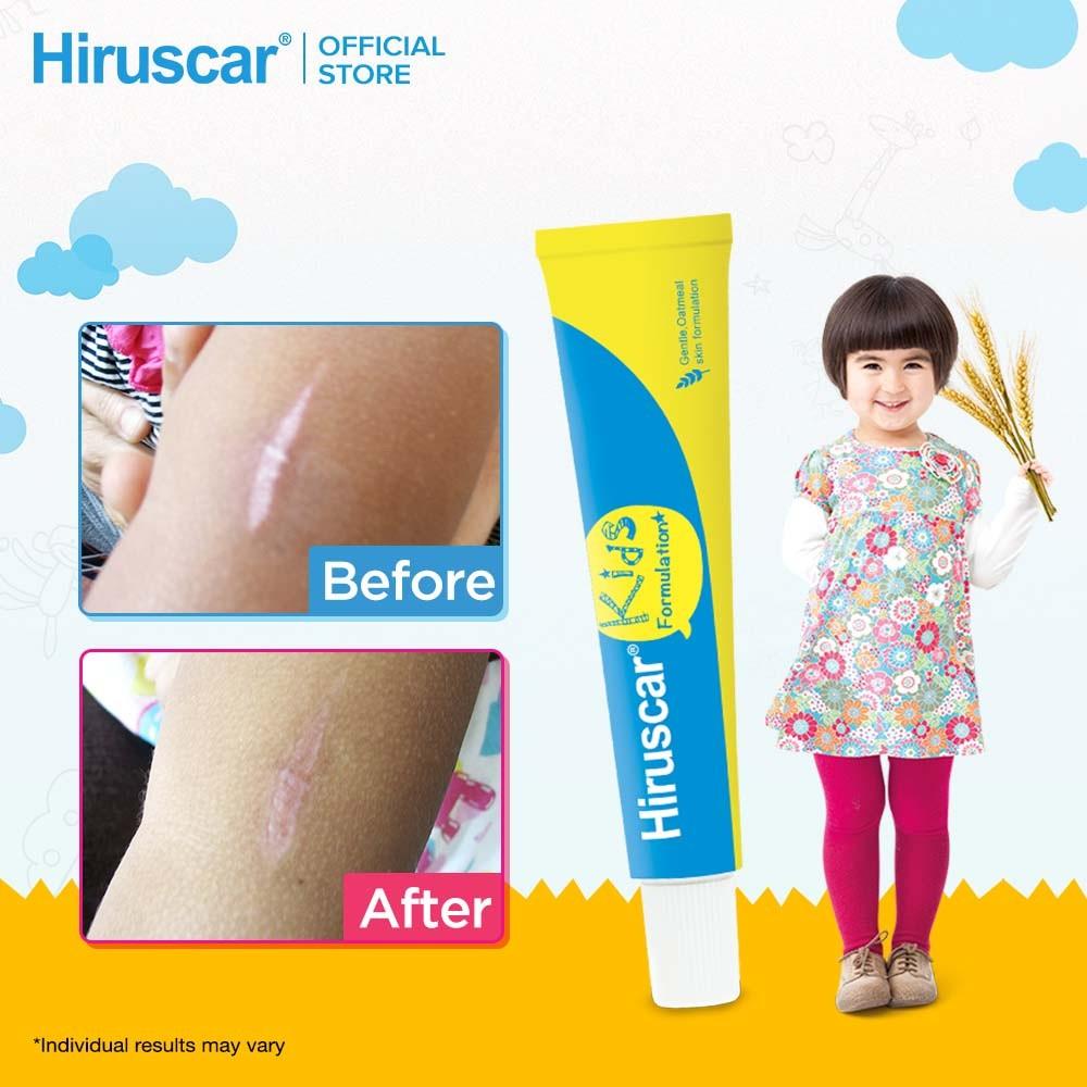 Brand New Hiruscar Kids Gel 20g Scar Treatment for Kids, Babies