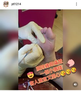 香港腳部護理64195857787777110