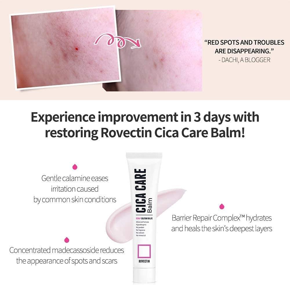 Rovectin Cica Care Balm, Beauty & Personal Care, Face, Face Care on ...