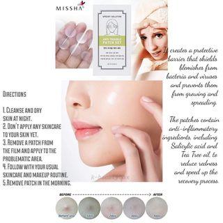 MISSHA ANTI TROUBLE PATCH (pimple patch)