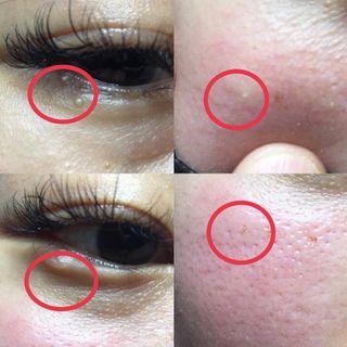 (Category: ) located in . Submitted by myskindiary (Listing ID 1170431572, Image 1). Description: .