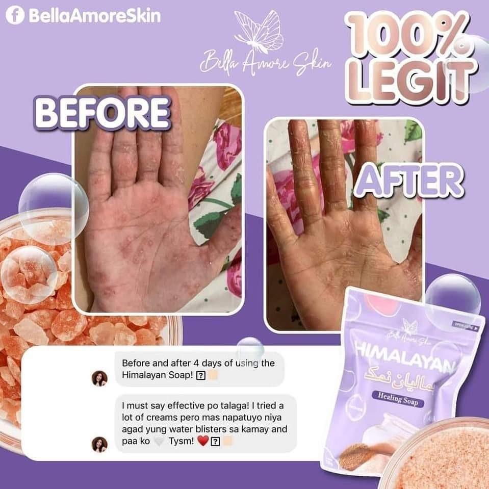 bella-amore-skin-himalayan-healing-soap-beauty-personal-care-bath