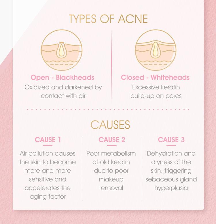 [30g] Jealousness Azelaic Acid Brightening Mask, Beauty & Personal Care, Face, Face Care on