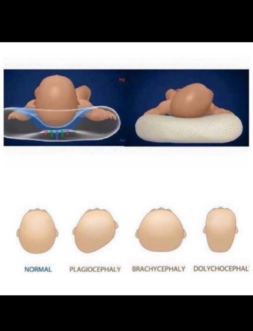 Mimos Pillow is the only medical grade baby pillow to prevent & correct