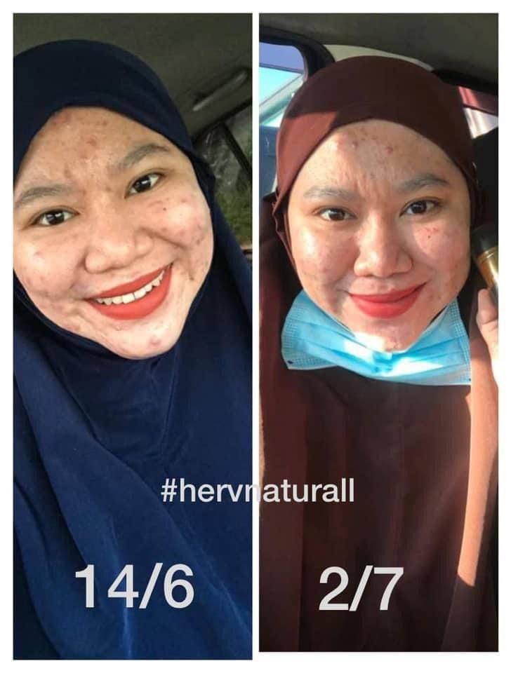 Water Tonic Advance, Beauty & Personal Care, Face, Face Care on Carousell