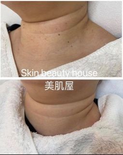 （分類：）位於 。 由 skinbeautyhouse 提交（商品編號 58531964，圖片 1）。簡介： 。