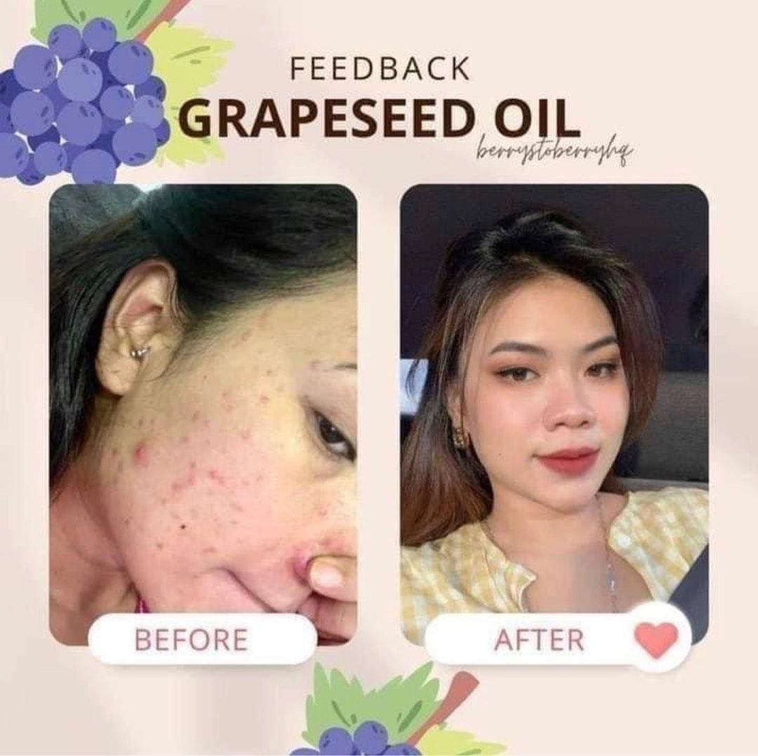 Grapeseed oil Viral, Beauty & Personal Care, Face, Face Care on Carousell