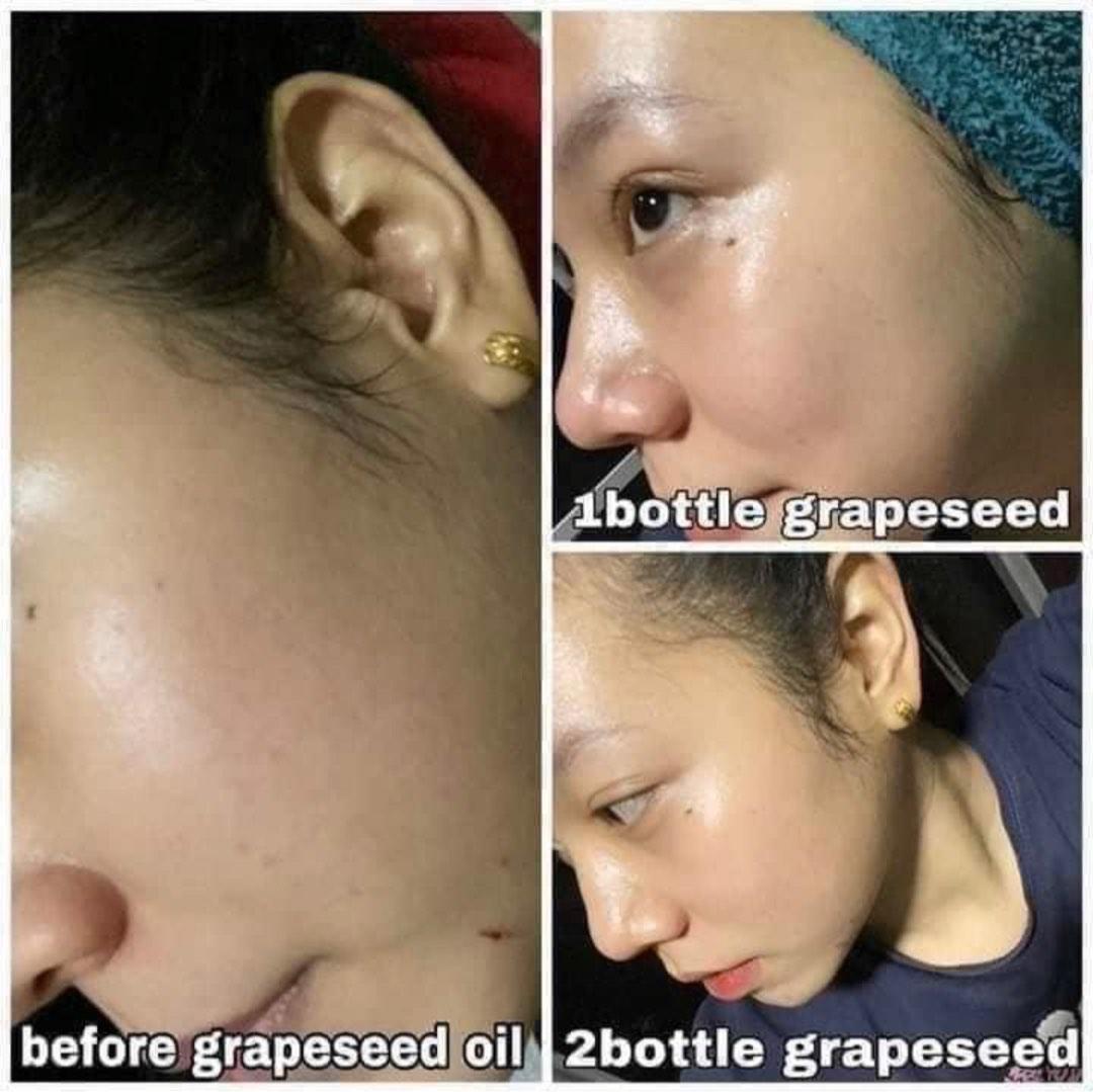 Grapeseed Oil Before And After atelieryuwa.ciao.jp