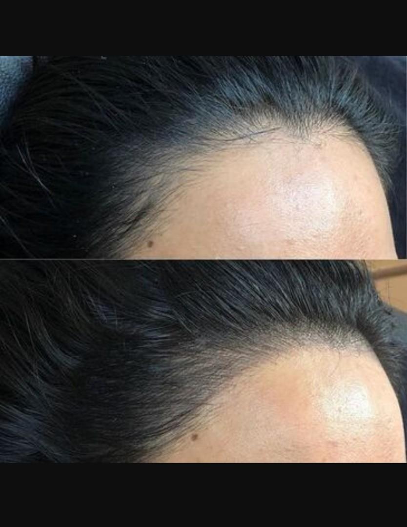 Model Needed (Category: Hair) located in Singapore. Submitted by coco_digo (Listing ID 1184873417, Image 1). Description: Hairline Embroidery 💁‍♀️ Model Needed 📅 Date : weekday 🕛 Time : 12pm - 6pm 📌 Location : Orchard Plaza 🚇 MRT : Somerset 🚞 Bus : 123 124.
